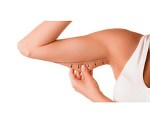 Arm Lift Surgery in Delhi - Dr Rajat Gupta