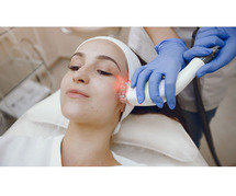 Best Q-switch Laser Toning Treatment in Delhi