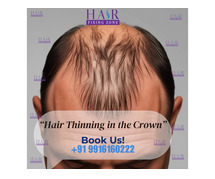 "Hair Thinning in the Crown? What You Can Do"