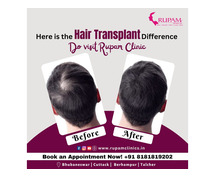 Restore Confidence at the Best Hair Transplant Clinic in Bhubaneswar