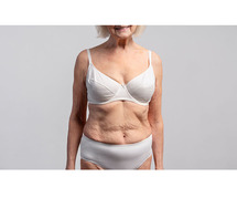 How to Get Rid of Excess Skin After Liposuction Surgery?