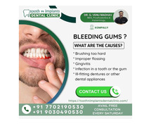 Best dental clinic kompally