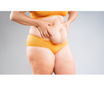 How Painful is a Tummy Tuck?