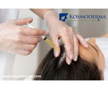 PRP Treatment for Hair Loss & Hair Fall in Bangalore | Kosmoderma Skin Clinic