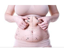 Sculpting Perfection: The Art and Science of Liposuction.