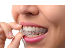 Invisalign Treatment Cost in Gurgaon