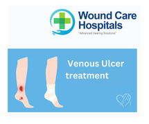 Best Venous Ulcer treatment in Hyderabad | Kukatpally | KPHB - WCH