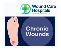 Chronic Wounds Treatment in hyderabad | Kukatpally | KPHB - WCH