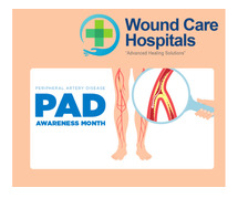 Peripheral Arterial Disease Treatment in Hyderabad | kukatpally - WCH