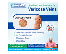 Varicose Veins Treatment in Hyderabad | kukatpally - Treatment Range Hospital