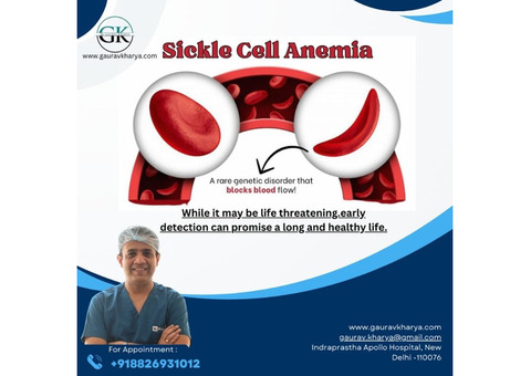 Best blood transfusion for treatment of sickle cell anemia