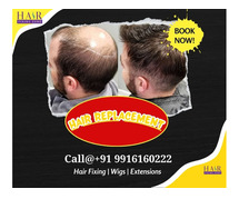 Non-Surgical Hair Replacement In Bangalore at Best Price