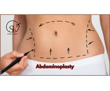 Abdominoplasty In Bangalore