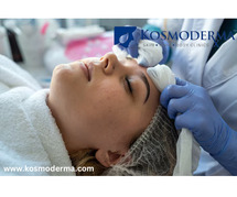 Forehead Acne, Acne Pigmentation & Laser Treatment in Bangalore | Kosmoderma Clinic