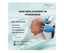 Scalp dandruff treatment in Hyderabad | 9959341999 | Angels Luxe