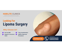 Looking for expert lipoma treatment in Delhi NCR