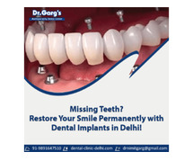 Missing Teeth? Restore Your Smile Permanently with Dental Implants in Delhi!