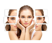 Acne scar Treatment in Chennai