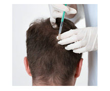 Exosome Hair Treatment