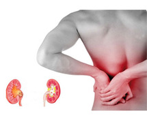 Kidney Stone Treatment