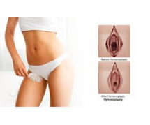 Hymenoplasty Surgery in Mumbai