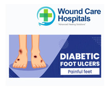 Best Diabetic Foot Ulcer Treatment in Hyderabad | Kukatpally | KPHB - WCH