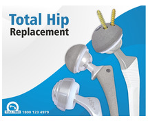 Restore Mobility with Advanced Total Hip Replacement Implants by Sharma Orthopedic!