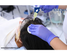 Leading Exosomes Treatment in Bangalore - Kosmoderma Skin Clinic