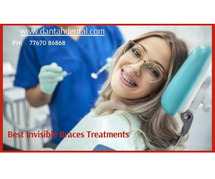 Ceramic Veneers / Crowns For Smile Makeover in Nashik