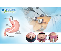 Expert Weight Loss Surgery in Bangalore by Dr. Lohith U