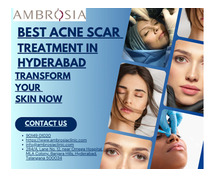 Best Acne Scar Treatment in Hyderabad – Transform Your Skin Now