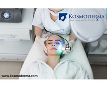 Best Laser Skin Lightening Treatment in Delhi | Achieve Glowing Skin at Kosmoderma