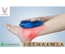 Acute Limb Ischemia Treatment in Hyderabad | Dr. Rahul Agarwal