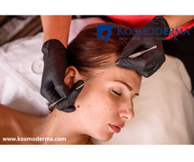 Best Dermatologist in Delhi for Pigmentation Treatment | Expert Care at Kosmoderma