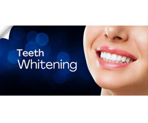 Best Teeth Whitening Clinic in Delhi