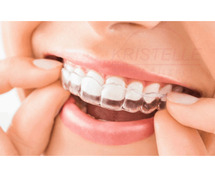 Invisible Clear Aligner | Orthodontic Clip in Tamilnadu