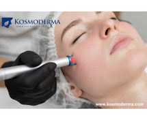 Laser Resurfacing Clinic in Delhi | Skin Rejuvenation at Kosmoderma