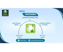 Teeth Whitening Tips- Gugu Dental clinic, Coimbatore