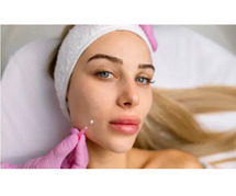 Thread Lift Treatment in Delhi