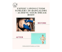 Expert Liposuction Surgery in Bangalore – Achieve Your Dream Body