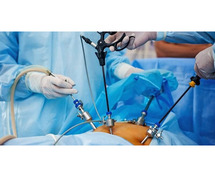 Best Laparoscopic Surgeon in Indore – Advanced Minimally Invasive Surgery