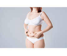 What is Diastasis Recti – How Can a Tummy Tuck Help?