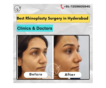 Best Rhinoplasty Surgery in Hyderabad | Clinics & Doctors