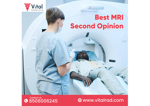 Best MRI Second Opinion