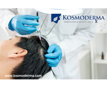 QR678 Treatment Cost in Delhi | Affordable Hair Regrowth at Kosmoderma