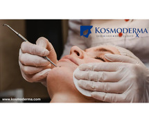 Top Pimple Treatment Clinic in Delhi | Best Dermatologist for Acne at Kosmoderma