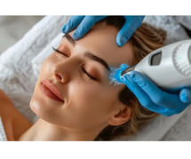 HIFU Treatment in Delhi - Non Surgical Face Lift