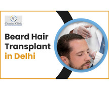 Beard Hair Transplant in Delhi