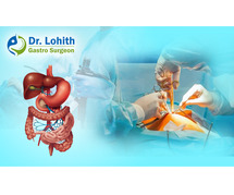 Best Surgical Gastroenterology in Bangalore with Dr. Lohith U