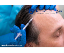 PRP Treatment for Hair Loss in Delhi | Restore Your Hair with Kosmoderma